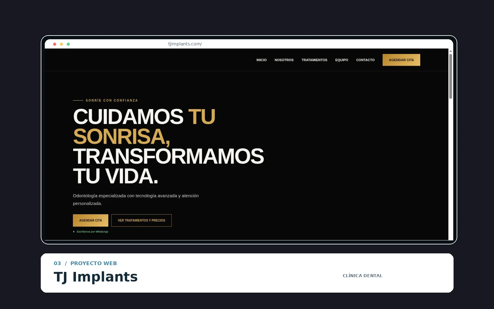 Portada de TJ Implants